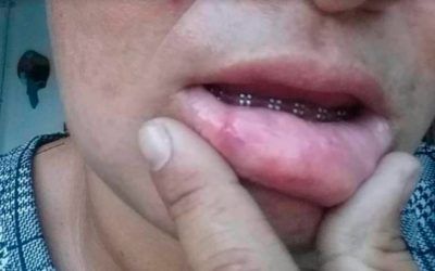 Mujer recibió torturas y cuatro días en prisión por reclamar gasolina en Cojedes